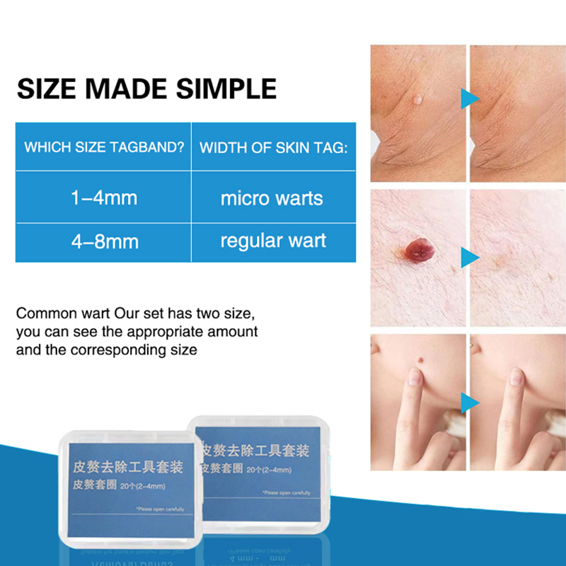 20pcs/Box Flesh Nevus Removal  - đánh giá và giá Men Accessories Kit